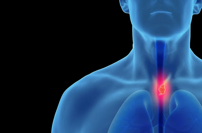  അന്നനാള കാന്‍സര്‍: നിശബ്ദമായി വളരുന്ന രോഗം; ഈ ലക്ഷണങ്ങള്‍ അവഗണിക്കരുത്