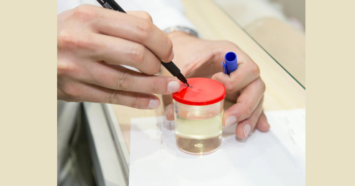  ഇനി മൂത്രം പറയും നിങ്ങളുടെ ‘യഥാര്‍ഥ’ പ്രായം! വാര്‍ധക്യം അളക്കാന്‍ പുതിയ കണ്ടുപിടിത്തവുമായി ചൈനീസ് ശാസ്ത്രജ്ഞര്‍