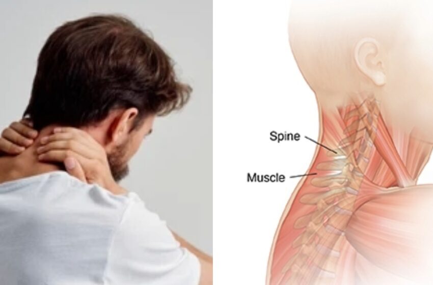  പെട്ടെന്ന് കഴുത്ത് ഉളുക്കിയാൽ എന്തു ചെയ്യണം? പരിഹാരമുണ്ട്‌