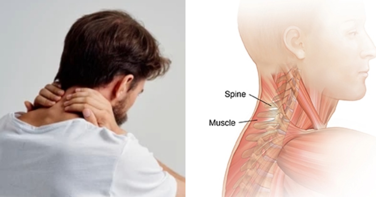 പെട്ടെന്ന് കഴുത്ത് ഉളുക്കിയാൽ എന്തു ചെയ്യണം? പരിഹാരമുണ്ട്‌