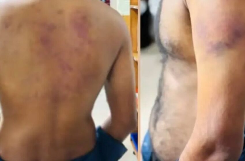  ലൈംഗികബന്ധത്തിന് വിസമ്മതിച്ചു; കൊച്ചിയിൽ ഭിന്നശേഷിക്കാരന് ക്രൂരമർദ്ദനം, യുവതിയുടെ സുഹൃത്തുക്കൾ പിടിയിൽ