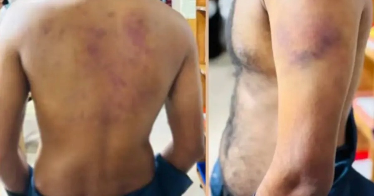 ലൈംഗികബന്ധത്തിന് വിസമ്മതിച്ചു; കൊച്ചിയിൽ ഭിന്നശേഷിക്കാരന് ക്രൂരമർദ്ദനം, യുവതിയുടെ സുഹൃത്തുക്കൾ പിടിയിൽ