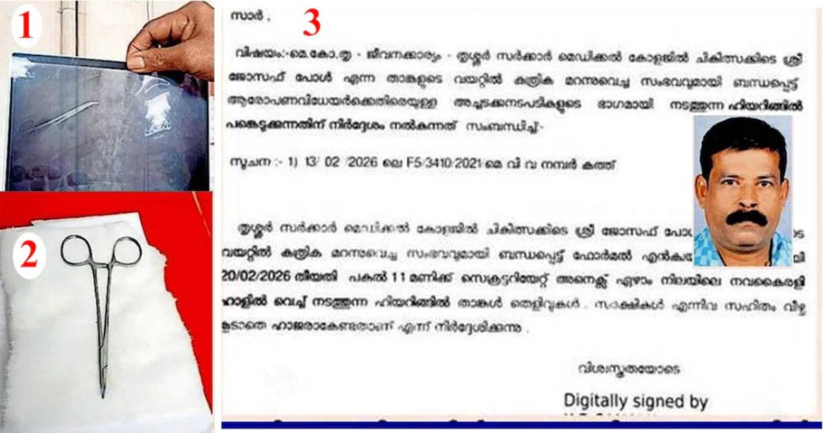 ശസ്ത്രക്രിയക്കിടെ കത്രിക കുടുങ്ങി; ഒരുവർഷം മുമ്പ് ആള് മരിച്ചു, തെളിവെടുപ്പിന് ഹാജരാകാൻ രോഗിക്ക് നോട്ടിസ്!
