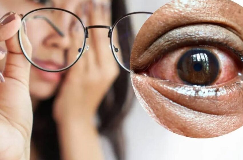  സുക്ഷിച്ചാൽ ദു:ഖിക്കേണ്ട; കണ്ണുകൾ നൽകുന്ന 5 ലക്ഷണങ്ങൾ അവഗണിക്കരുത്