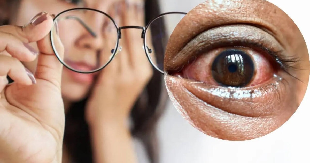 You said കാഴ്ച നഷ്ടപ്പെട്ടേക്കാം; കണ്ണുകൾ നൽകുന്ന 5 ലക്ഷണങ്ങൾ അവഗണിക്കരുത്