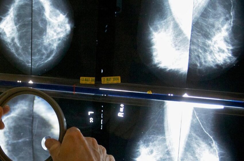  30 വർഷം, ഇരട്ടിയിലധികം കേസുകൾ: ഇന്ത്യയിൽ സ്തനാർബുദം പടരുന്നു