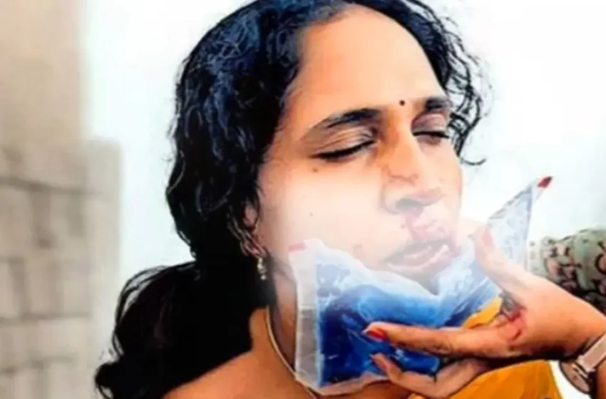  ഗെയിം കളിക്കുന്നത് തടഞ്ഞു; അധ്യാപികയുടെ മൂക്കിടിച്ചു തകർത്ത് വിദ്യാർഥി