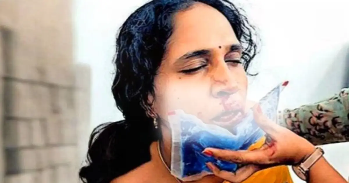 ഗെയിം കളിക്കുന്നത് തടഞ്ഞു; അധ്യാപികയുടെ മൂക്കിടിച്ചു തകർത്ത് വിദ്യാർഥി