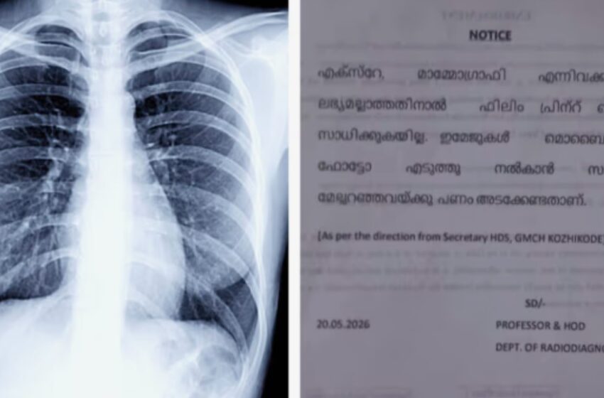  കോഴിക്കോട് മെഡിക്കൽ കോളേജിൽ എക്സ്-റേ ഫിലിമില്ല; രോഗികൾ മൊബൈലിൽ ഫോട്ടോയെടുക്കേണ്ട ഗതികേട്