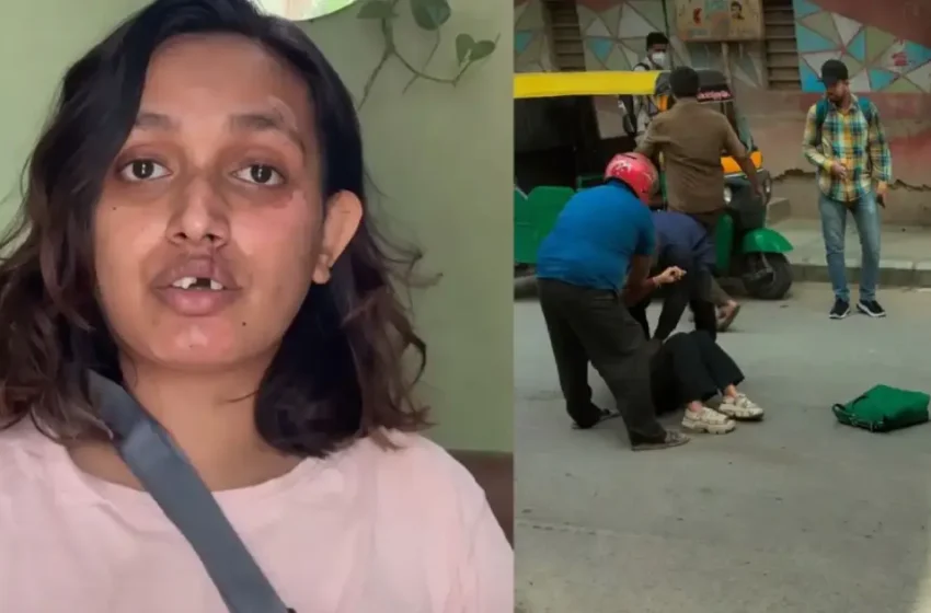  ‘ട്രാക്ടർ ശരീരത്തിലൂടെ കയറിയിറങ്ങി, ജീവനായി പോരാടുമ്പോള്‍ ഈ പച്ചക്കള്ളം താങ്ങാനാവില്ല’; റാപ്പിഡോക്കെതിരെ കോഴിക്കോട് സ്വദേശി സാനി കൃഷ്ണ