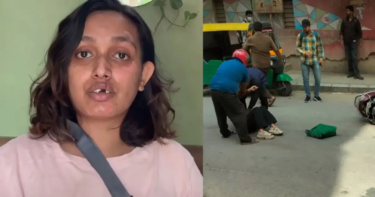 ‘കമ്പനിയിൽ നിന്ന് ഒരു രൂപ പോലും ലഭിച്ചില്ല, വാർത്തകൾ പച്ചക്കള്ളം’; റാപ്പിഡോയുടെ വാദങ്ങൾ തള്ളി അപകടത്തിൽ പരിക്കേറ്റ സാനി കൃഷ്ണ