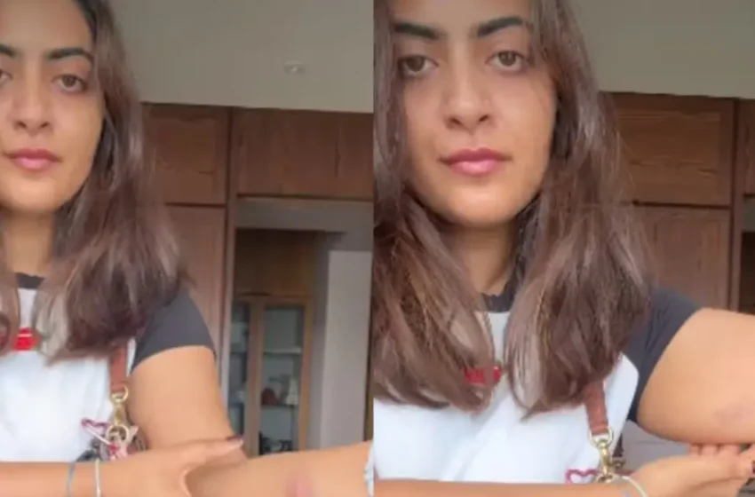  ‘ഡമോക്രസി ഫിറ്റ് ചെക്ക്’: കസ്റ്റഡിയിൽ പോലീസിന്റെ ക്രൂര മർദനം; ശരീരമാസകലം മർദനമേറ്റ പാടുകൾ തുറന്നുകാട്ടി ആമിർ ഖാന്റെ അനന്തരവൾ